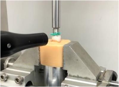 Application of non-destructive testing methods for assessing fracture resistance in dental ceramics: the sound harvesting test